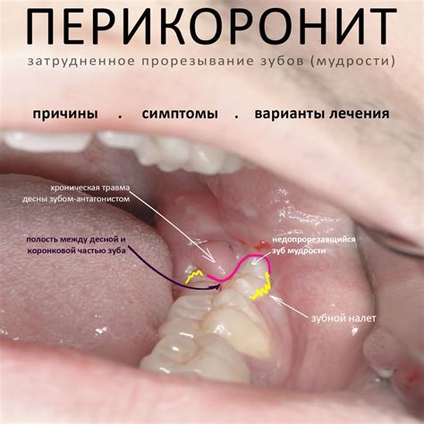 Симптомы и признаки роста