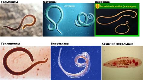 Симптомы наличия паразитических червей в организме: как их распознать?
