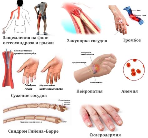 Симптомы онемения руки