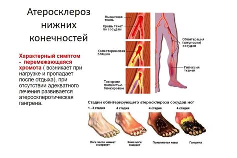 Симптомы пареза конечностей нижних у взрослых: