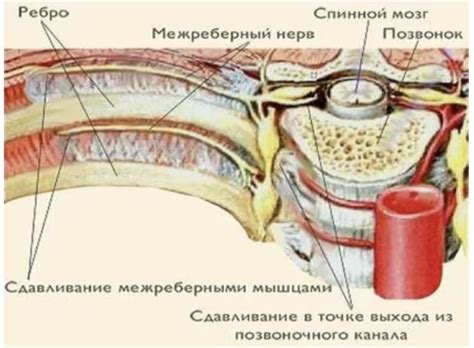 Симптомы продувания грудной клетки: как их распознать?