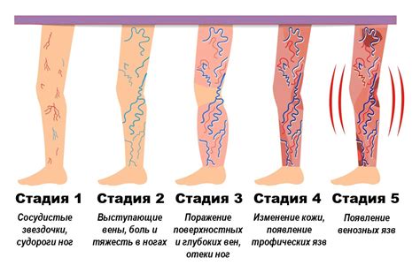 Симптомы тряски ног у девушек