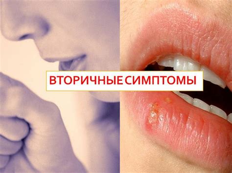 Симптомы Streptococcus oralis у женщин