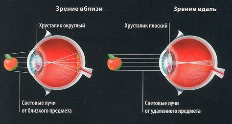 Синдром компьютерного зрения