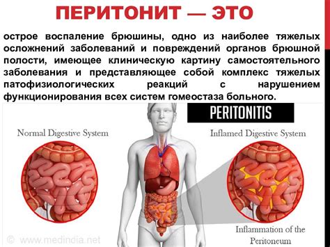 Системные заболевания, приводящие к низкому давлению и головокружению утром