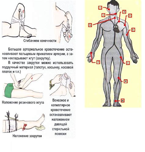 Сложности в остановке кровотечения