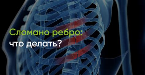 Сломал ребро: как оказать первую помощь в домашних условиях