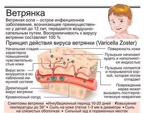 Сновидения как дополнительный фактор в определении течения вируса ветрянки