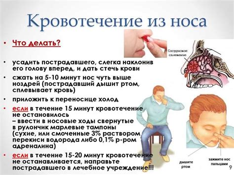 Сон про кровь из носа