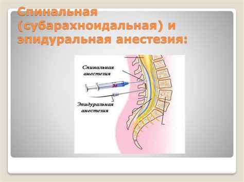 Спинальная анестезия и эпидуральная: основные различия