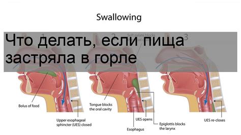 Срочные действия, если монетка застряла в горле