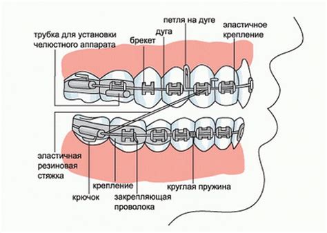 Стандартный срок ношения кап