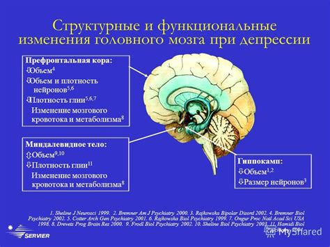 Структурные изменения мозга при депрессии