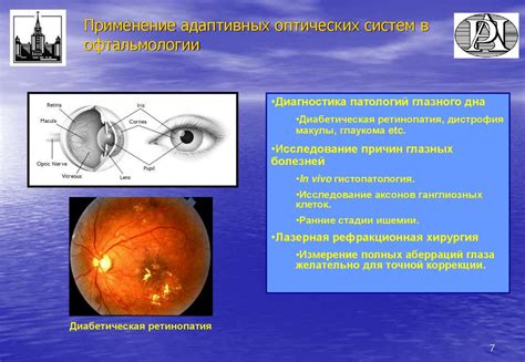 Сфера в офтальмологии: основные характеристики и применение