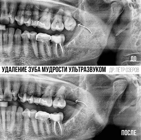 Тема 1: События, ведущие к сновидению о удалении неустойчивого зуба