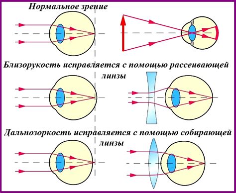 Тема 2: Понимание нечистых очков для зрения в мечтах