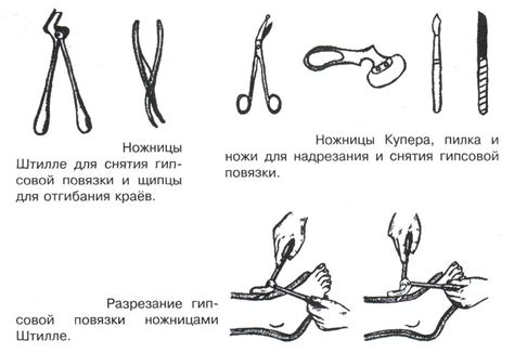 Техника снятия повязки