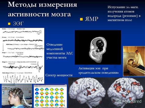 Техники и методы измерения активности мозга