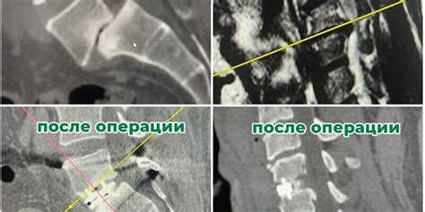 Типичные операции, выполняемые нейрохирургами