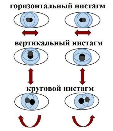 Типичные ситуации, когда ребенок может закатывать глаза