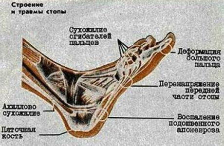 Толкования сна о повреждении ноги в разных культурах