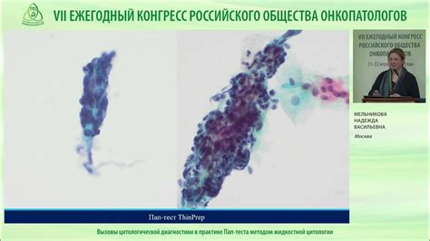 Точность результатов Пап-теста и жидкостной цитологии