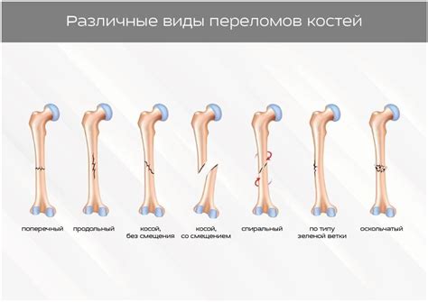 Травмы и переломы как причина опухшей лапы и хромоты