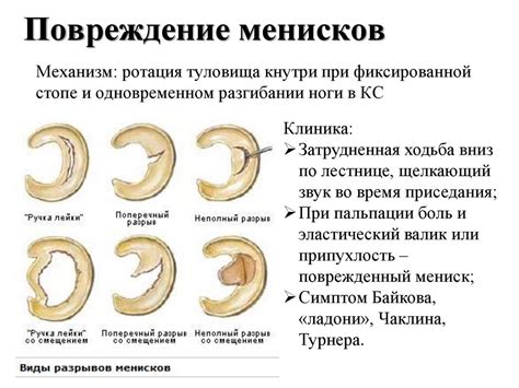 Травмы и повреждения коленного сустава: какие случаи требуют оперативного вмешательства