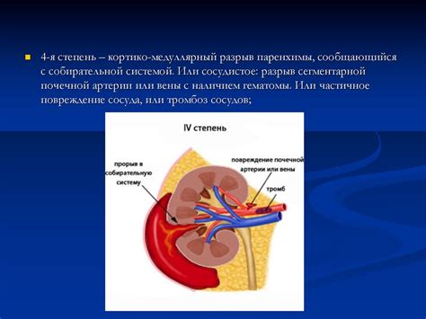 Травмы мочеполовой системы