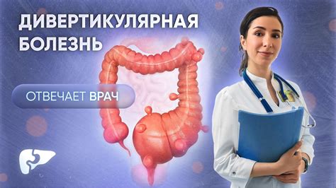 Туберкулез толстой кишки: причины и лечение