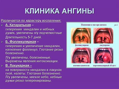 Увеличение чувствительности горла