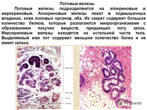 Усиленное секрецирование сальных желез