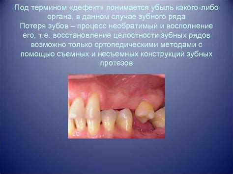 Успех в делах: сновидение о целостности зубов