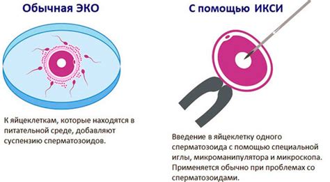 Успех культивирования эмбрионов при ЭКО-ИКСИ