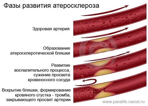 Факторы, влияющие на липидный обмен