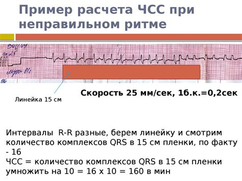 Факторы, влияющие на частоту сердечных сокращений