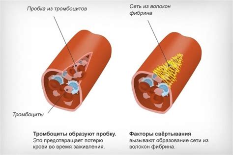 Феномен крови в сновидениях: причины и возможные осложнения