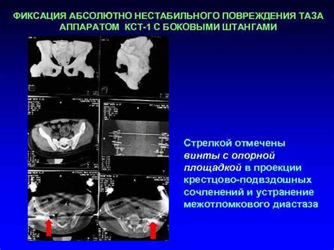 Фиксация повреждения