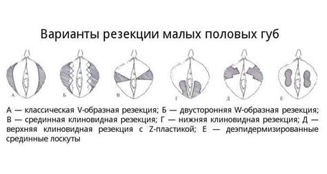 Форма и внешний вид