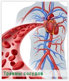 Форма повреждения кровеносных сосудов