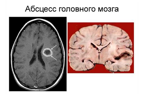 Формирование искр в голове