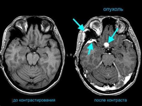 Что выбрать в качестве контраста при КТ?