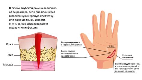 Что делать, если сломалась лангетка на руке?