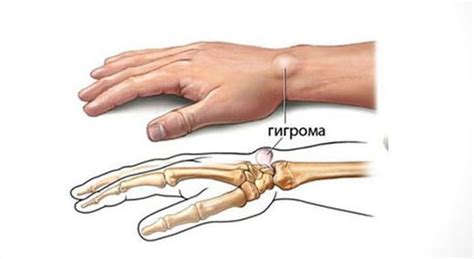 Что делать, если чешется запястье левой руки?