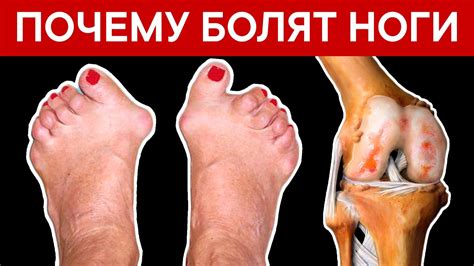 Что делать при боли в ногах: 8 способов снять боль и дискомфорт