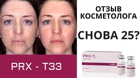 Что означает пилинг PRX T33?