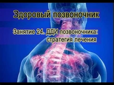 Что такое дегенеративно дистрофические изменения скелета?