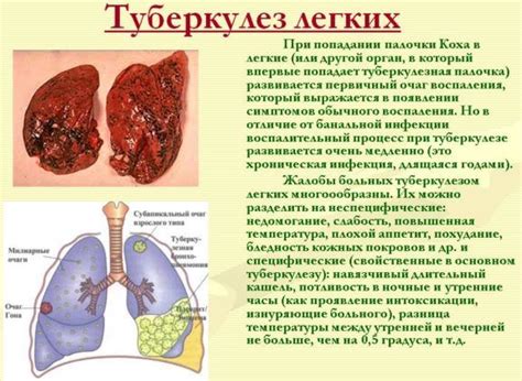 Что такое множественные очаги в легких?