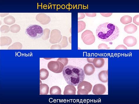 Что такое палочкоядерные нейтрофилы?