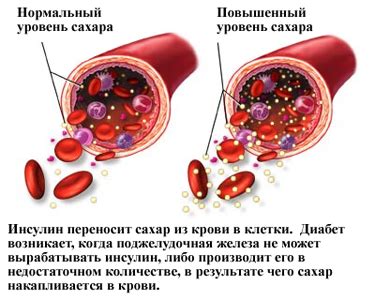 Что такое повышенный рой в крови?